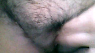 My hairy